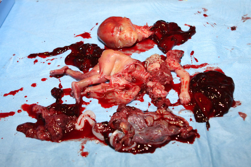 Abortion2.jpg